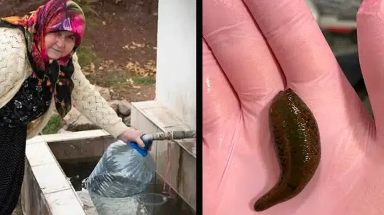 Çorum'da su içerken boğazına canlı sülük kaçan öğretmenin yaşadığı korkunç olay