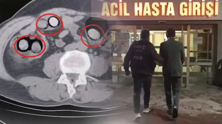 Bitlis'te Yolcu Otobüsünde Midesinden 758 Gram Metamfetamin Çıktı