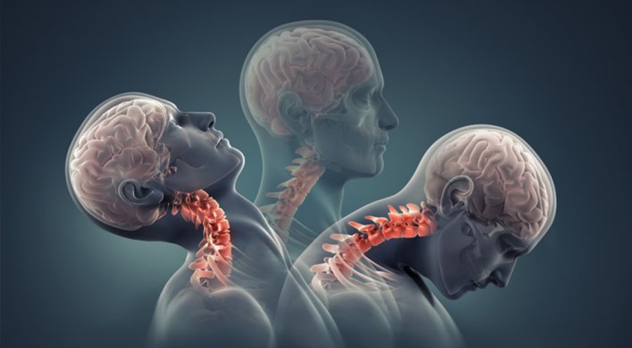 Bu hareketleri siz de yapıyor olabilirsiniz! Boyun fıtığı riskini artıran yanlışlar 3