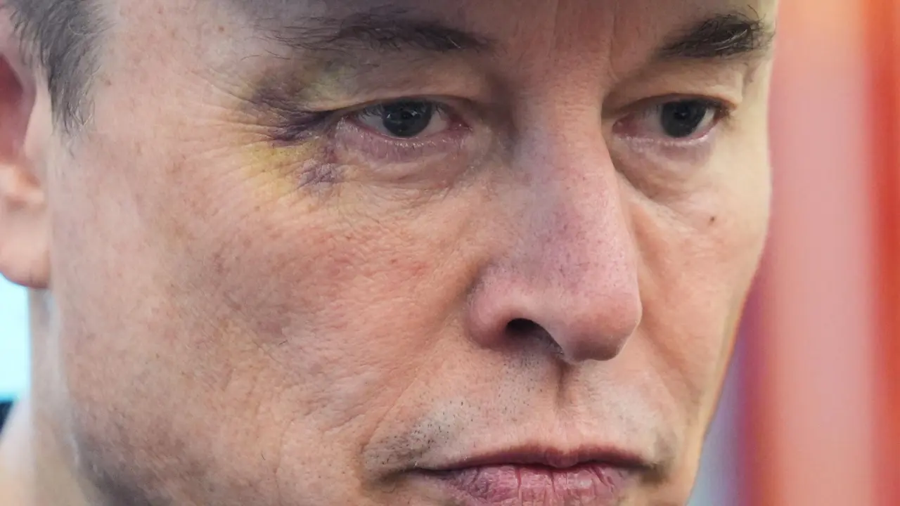 Elon Musk explains his black eye at Oval Office goodbye event with Trump | wusa9.com